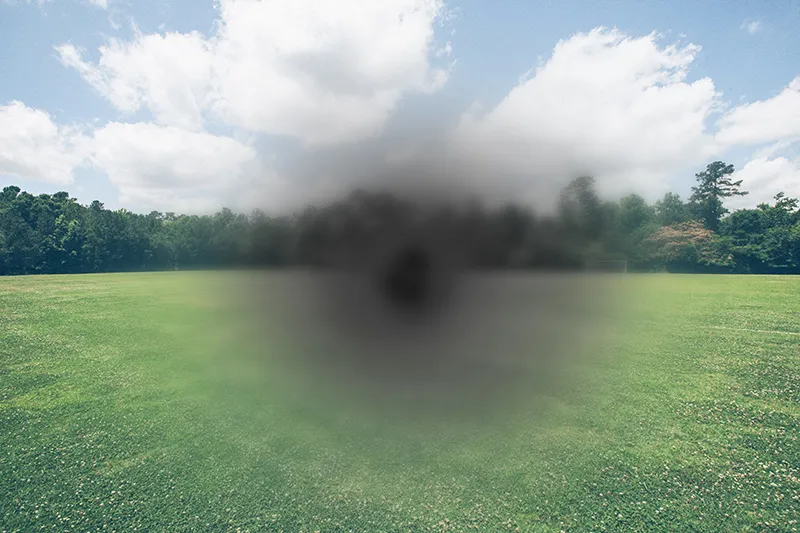 Macular,Degeneration,(amd,Or,Armd)-,Is,A,Medical,Condition,Which